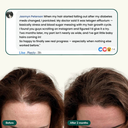 Strawberry Regrowth Gummies