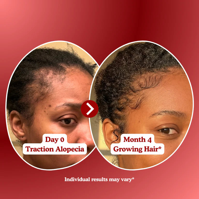 LUMIN - Hair Growth Gummies