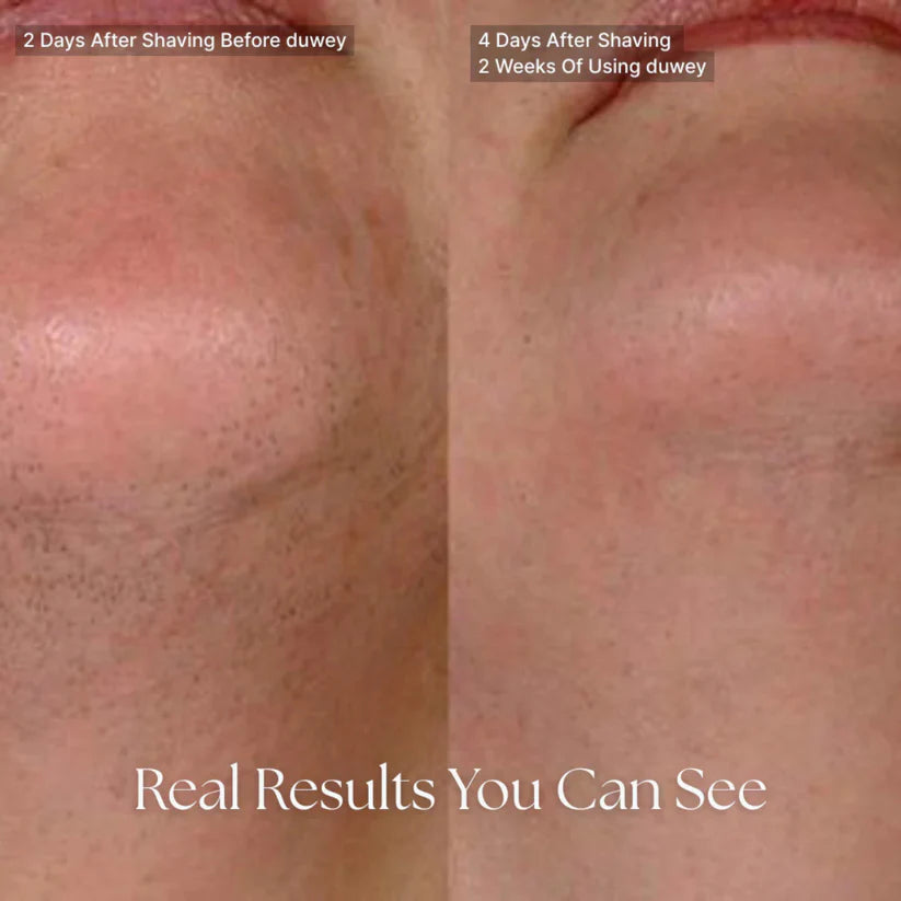 Cyperus Rotundus Oil™ for Hair Removal