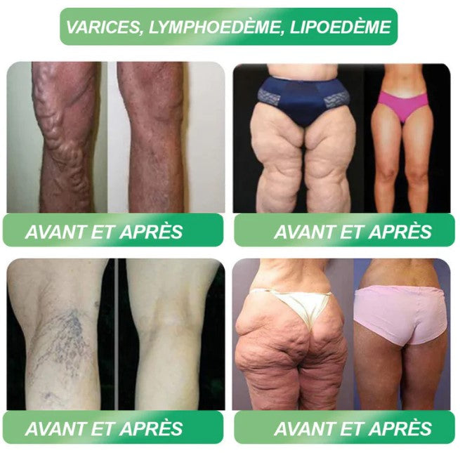 GLP-1 Six in One: the secret to natural weight loss